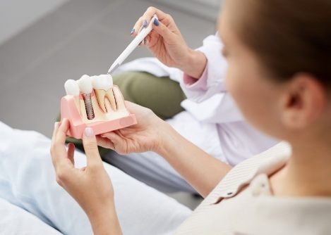 Dentist showing a dental implant model to a patient