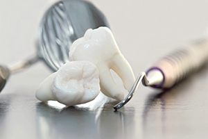 Two teeth resting on table next to dental instruments