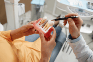 a patient chatting with their dental implant surgeon about a dental implant model